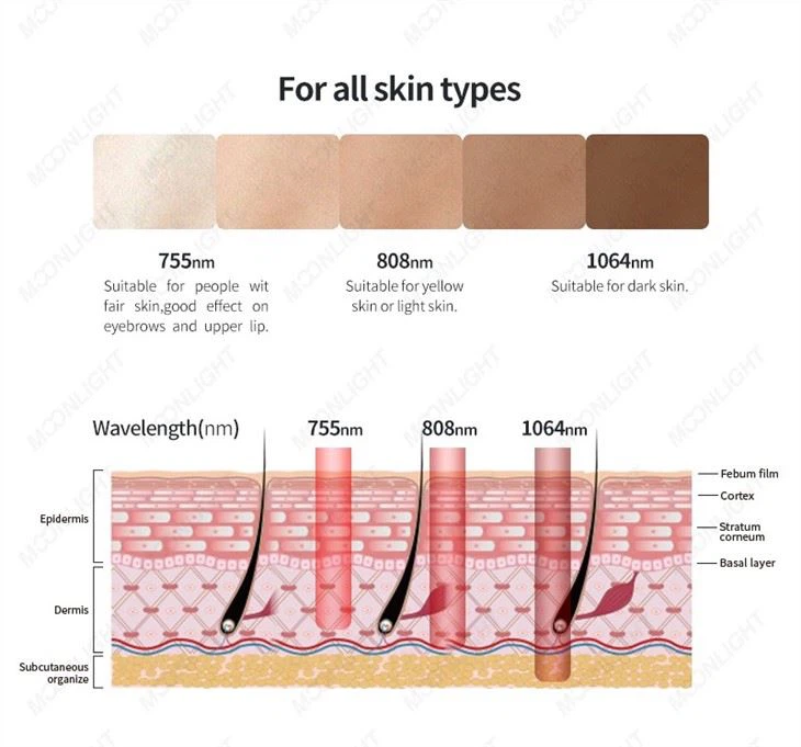 Laser Beauty Equipment Soprano Titanium
