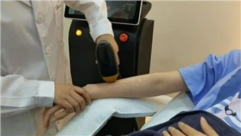 Mašina za uklanjanje dlačica sa laserskom diodom sa optičkim vlaknima