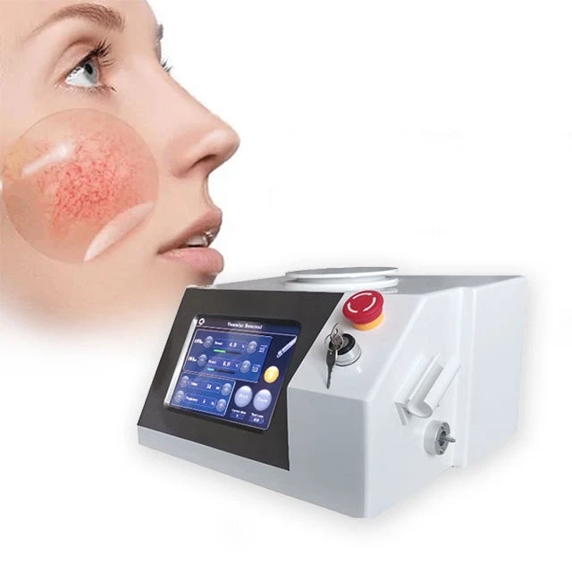 Medical CE Endovenous Treatment Endolift
