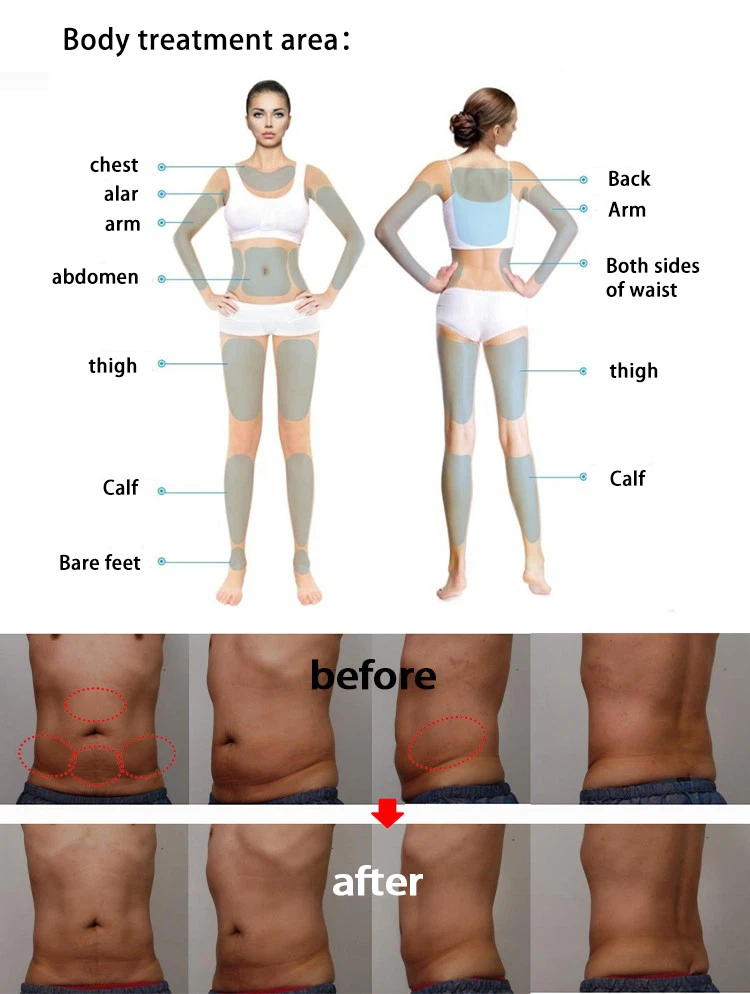 7D HIFU Machine: Your Ultimate Anti-Aging Solution