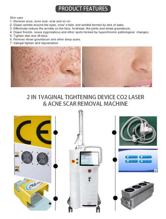 Co2 Laser Resurfacing Machine Cost